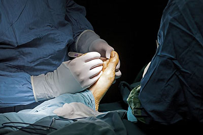 Foot Surgery